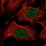 ZSCAN9 Antibody in Immunocytochemistry (ICC/IF)