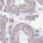 ZSCAN9 Antibody in Immunohistochemistry (IHC)