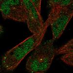 DAAM2 Antibody in Immunocytochemistry (ICC/IF)