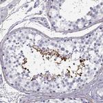 GTSF1L Antibody in Immunohistochemistry (IHC)