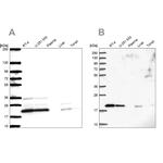 NDUFAF2 Antibody in Western Blot (WB)