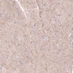 PTPRK Antibody in Immunohistochemistry (IHC)