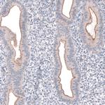 PTPRK Antibody in Immunohistochemistry (IHC)