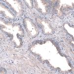 PTPRK Antibody in Immunohistochemistry (IHC)