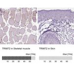 TRIM72 Antibody