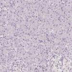 DNAJC6 Antibody in Immunohistochemistry (IHC)