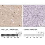 DNAJC6 Antibody