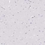 DCAF17 Antibody in Immunohistochemistry (IHC)