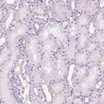 PRM1 Antibody in Immunohistochemistry (IHC)