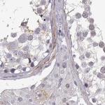 VGF Antibody in Immunohistochemistry (IHC)