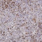 MYO1F Antibody in Immunohistochemistry (IHC)