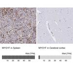 MYO1F Antibody