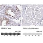 Cdc20 Antibody in Immunohistochemistry (IHC)