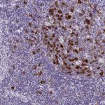 Cdc20 Antibody in Immunohistochemistry (IHC)