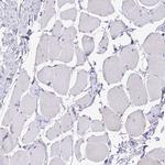 Cdc20 Antibody in Immunohistochemistry (IHC)