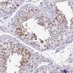 Cdc20 Antibody in Immunohistochemistry (IHC)