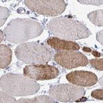 Calsequestrin 2 Antibody in Immunohistochemistry (IHC)