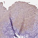 UPP1 Antibody in Immunohistochemistry (IHC)