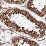 ZW10 Antibody in Immunohistochemistry (IHC)