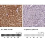 ALDH8A1 Antibody in Immunohistochemistry (IHC)