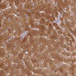 ALDH8A1 Antibody in Immunohistochemistry (IHC)