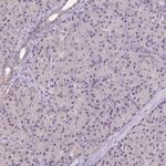 ALDH8A1 Antibody in Immunohistochemistry (IHC)