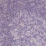 ALDH8A1 Antibody in Immunohistochemistry (IHC)