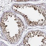 SNRPC Antibody in Immunohistochemistry (IHC)