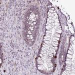 RRS1 Antibody in Immunohistochemistry (IHC)