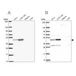 RRS1 Antibody in Western Blot (WB)