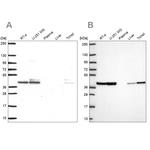 STRAP Antibody in Western Blot (WB)