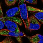 MGAM2 Antibody in Immunocytochemistry (ICC/IF)