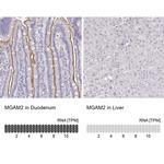 MGAM2 Antibody in Immunohistochemistry (IHC)