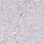 MGAM2 Antibody in Immunohistochemistry (IHC)