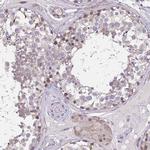 CHST3 Antibody in Immunohistochemistry (IHC)