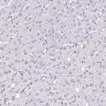 PLS1 Antibody in Immunohistochemistry (IHC)