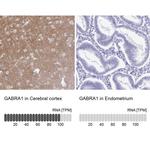 GABRA1 Antibody