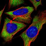 RPS5 Antibody in Immunocytochemistry (ICC/IF)