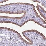 RPS5 Antibody in Immunohistochemistry (IHC)