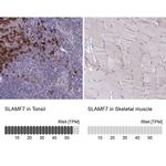 CRACC Antibody in Immunohistochemistry (IHC)