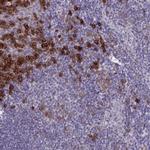 CRACC Antibody in Immunohistochemistry (IHC)