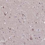 DIP2B Antibody in Immunohistochemistry (IHC)