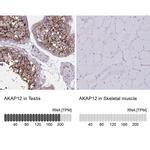 AKAP12 Antibody in Immunohistochemistry (IHC)