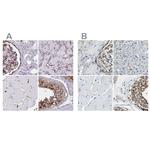 AKAP12 Antibody in Immunohistochemistry (IHC)