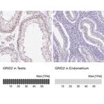 GRID2 Antibody in Immunohistochemistry (IHC)