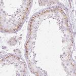 GRID2 Antibody in Immunohistochemistry (IHC)