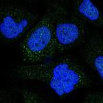 COL9A2 Antibody in Immunocytochemistry (ICC/IF)