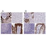 HSD11B2 Antibody in Immunohistochemistry (IHC)