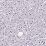 HSD11B2 Antibody in Immunohistochemistry (IHC)