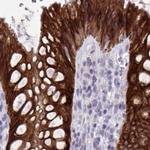 HSD11B2 Antibody in Immunohistochemistry (IHC)